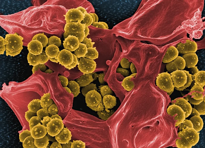 Microbiome